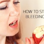Bleeding Gums