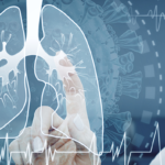 Lungs Screenings